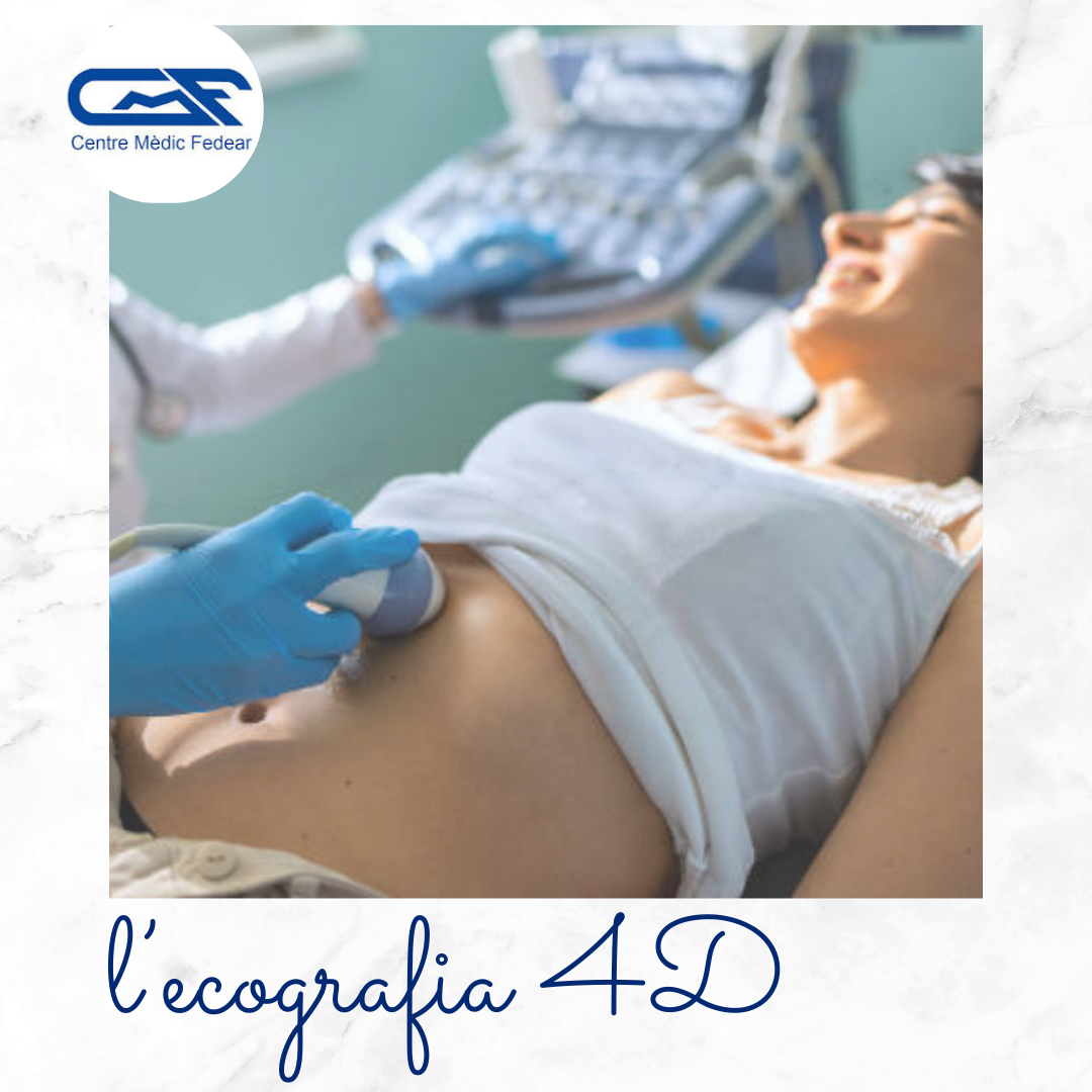 Ecografia 4D Ecografia 4D